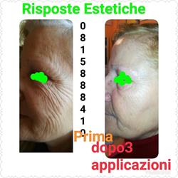 Risposte Estetiche Di Lucia Minopoli Napoli, Pianura - Orari di apertura