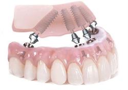 Studio Dentistico Belmonte, Sarno orari di apertura
