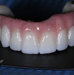 TECNODENTAL di Montagnoli Fabio LAB.PROTESI DENTALE, Fiorano Canavese orari di apertura