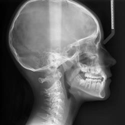3D Radiologia Treviso, orari di apertura