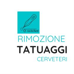 Rimozione Tatuaggi Cerveteri, orari di apertura