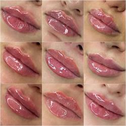 Dottoressa Fanta Natasha - Trattamenti estetici & Filler Labbra, Torino orari di apertura