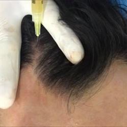 PRP Napoli - Tricologia, orari di apertura