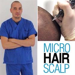 Micro Hair Scalp Tricopigmentazione Sicilia, Marsala orari di apertura
